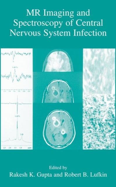 Book cover of: MR Imaging and Spectroscopy of Central Nervous System Infection