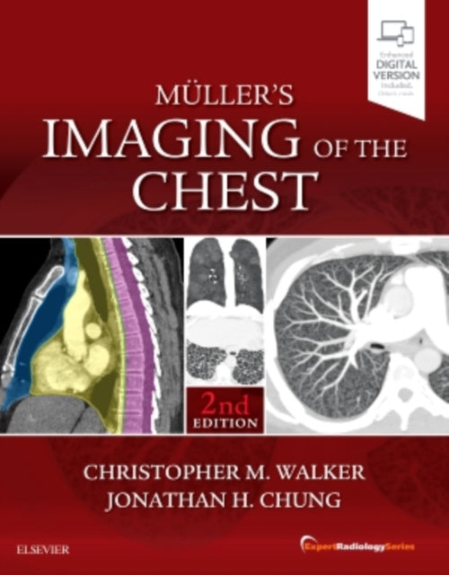 Book cover of: Muller's Imaging of the Chest. By: Christopher Walker