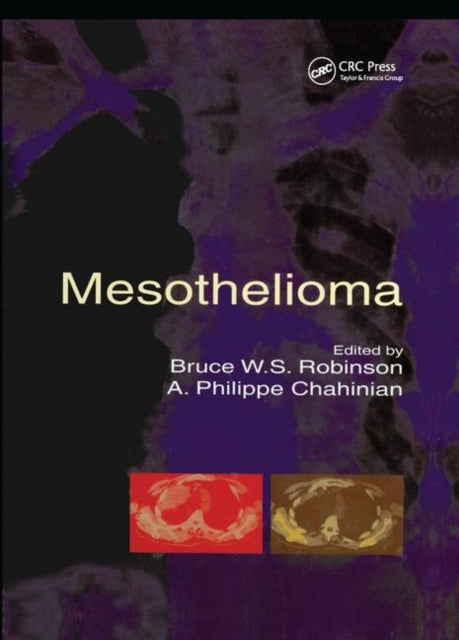 Book cover of: Mesothelioma. By: Bruce W. S. Robinson