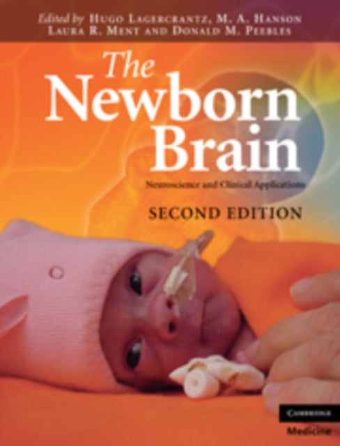Book cover of: Newborn Brain. By: Hugo Lagercrantz