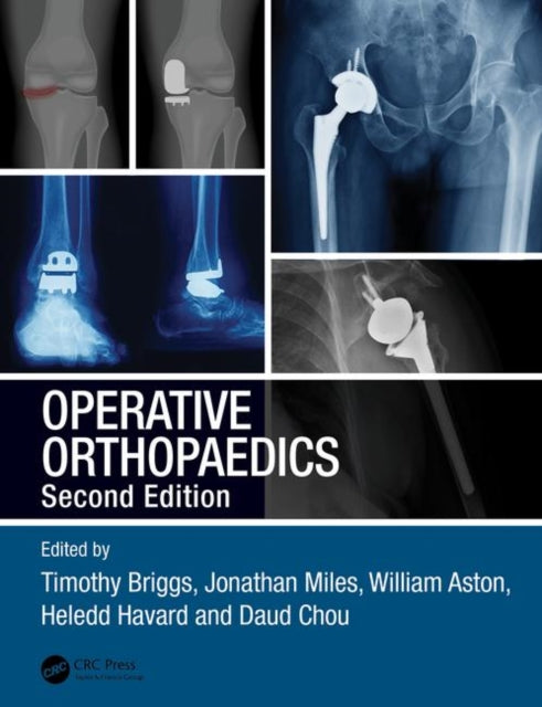 Book cover of: Operative Orthopaedics. By: Timothy Briggs