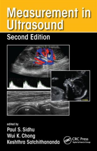 Book cover of: Measurement in Ultrasound. By: Paul S. Sidhu