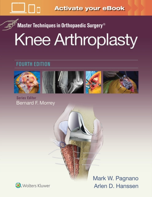 Book cover of: Master Techniques in Orthopedic Surgery: Knee Arthroplasty. By: Mark W. Pagnano MD