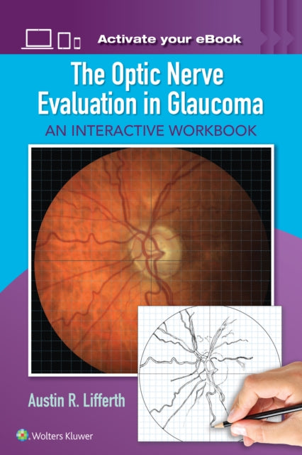 Book cover of: Optic Nerve Evaluation in Glaucoma. By: Austin Lifferth