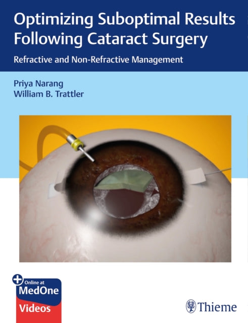 Book cover of: Optimizing Suboptimal Results Following Cataract Surgery. By: Priya Narang
