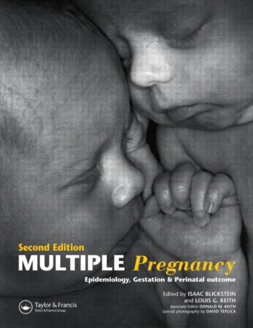 Book cover of: Multiple Pregnancy