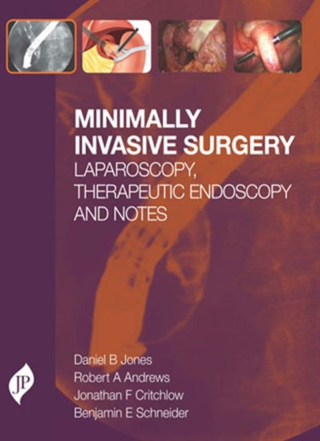 Book cover of: Minimally Invasive Surgery. By: Daniel B. Jones