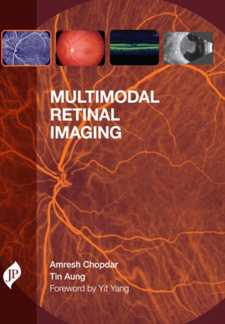 Book cover of: Multimodal Retinal Imaging