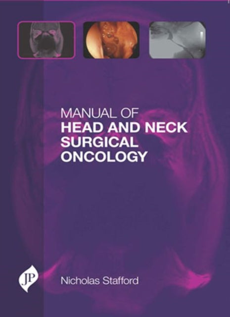Book cover of: Manual of Head and Neck Surgical Oncology. By: Nick Stafford