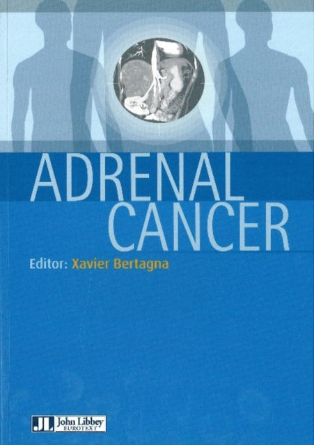 Book cover of: Adrenal Cancer. By: Xavier Bertagna