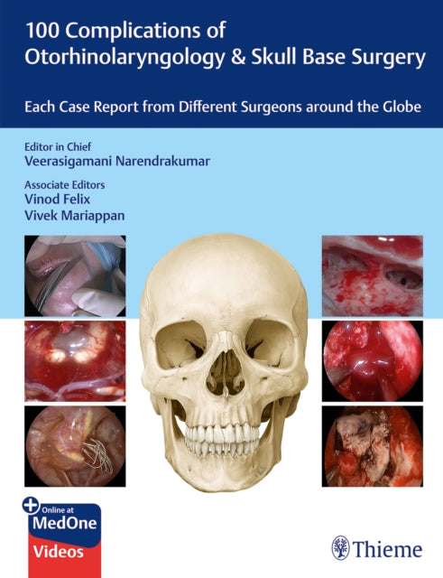 Book cover of: 100 Complications of Otorhinolaryngology & Skull Base Surgery. By: Veerasigamani Narendrakumar