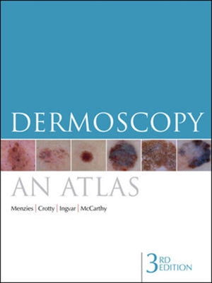 Dermoscopy