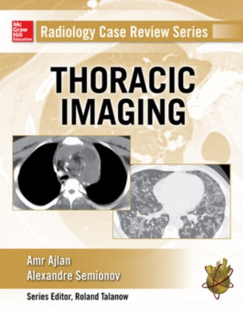 Book cover of: Radiology Case Review Series: Thoracic Imaging. By: Amr M. Ajlan