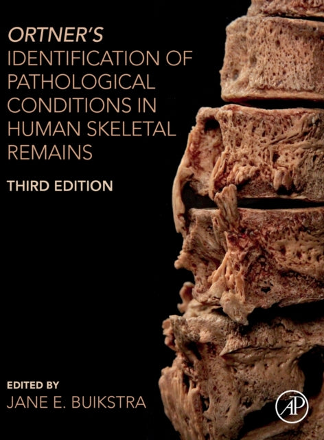 Book cover of: Ortner's Identification of Pathological Conditions in Human Skeletal Remains