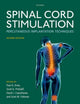 Book cover of: Spinal Cord Stimulation. By: Paul G. Kreis