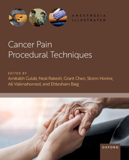 Book cover of: Cancer Pain Procedural Techniques. By: Gulati