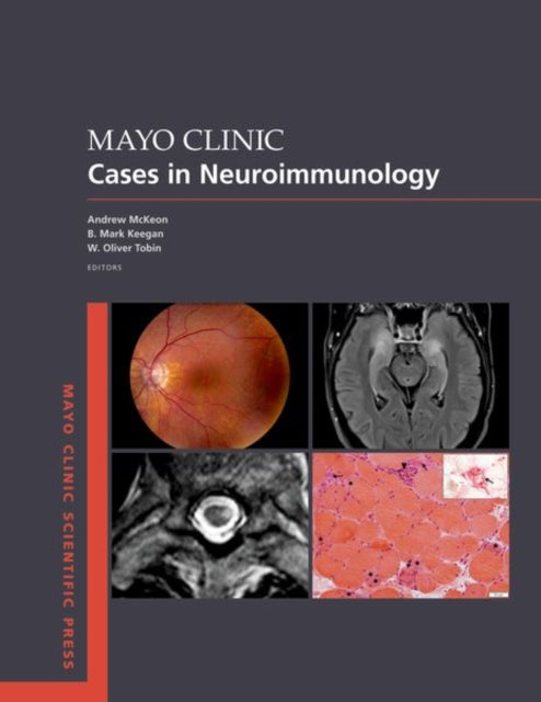 Book cover of: Mayo Clinic Cases in Neuroimmunology. By: Andrew McKeon