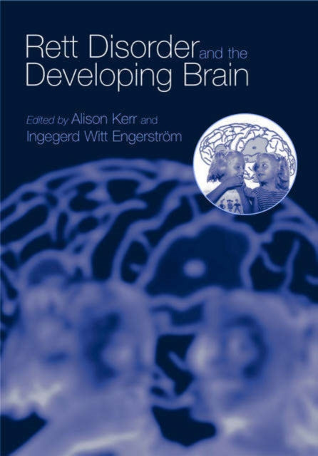 Book cover of: Rett Disorder and the Developing Brain