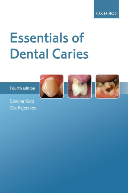 Book cover of: Essentials of Dental Caries