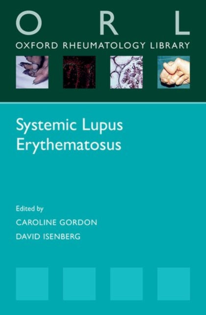 Book cover of: Systemic Lupus Erythematosus