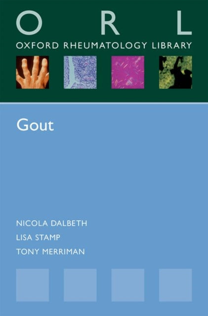 Book cover of: Gout. By: Nicola Dalbeth