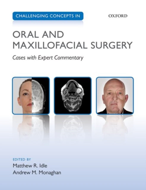 Book cover of: Challenging Concepts in Oral and Maxillofacial Surgery. By: Matthew R. Idle