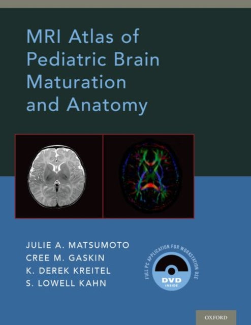 Book cover of: MRI Atlas of Pediatric Brain Maturation and Anatomy. By: Julie A. Matsumoto