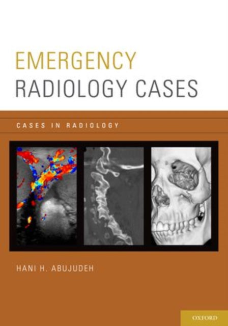 Book cover of: Emergency Radiology Cases