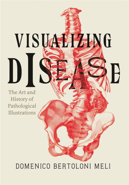 Book cover of: Visualizing Disease. By: Domenico Bertoloni Meli