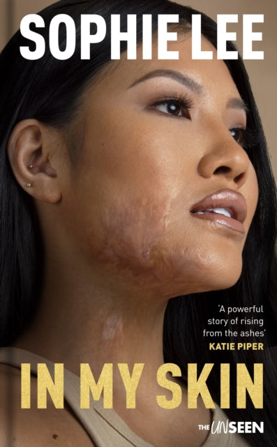 Book cover of: In My Skin