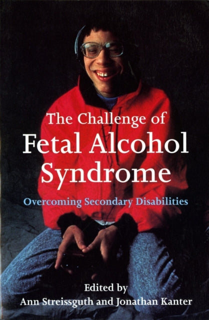 Book cover of: Challenge of Fetal Alcohol Syndrome