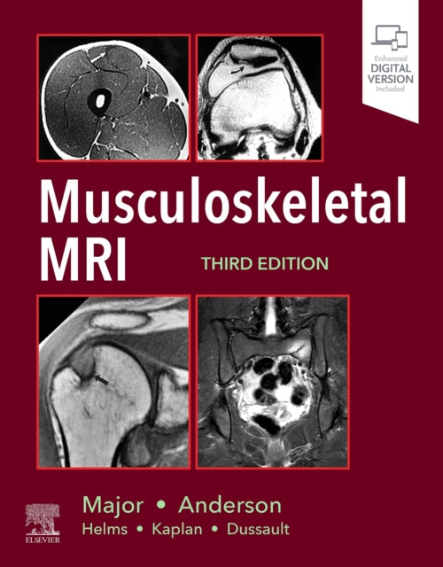 Book cover of: Musculoskeletal MRI. By: Mark W. Anderson