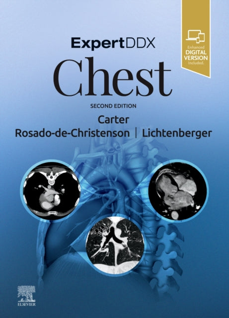 Book cover of: ExpertDDx: Chest. By: Melissa L. Rosado-de-Christenson