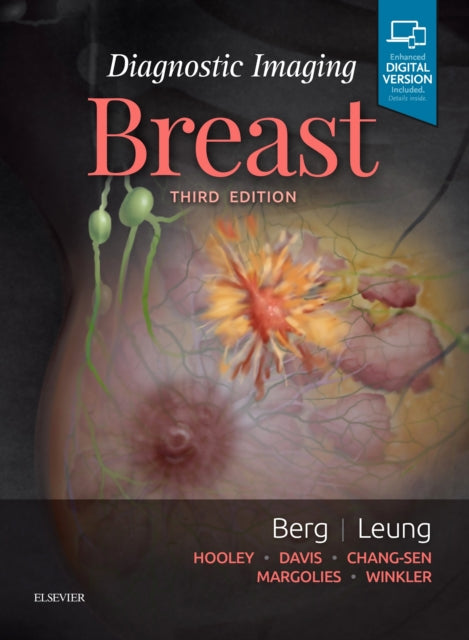 Book cover of: Diagnostic Imaging: Breast. By: Wendie A. Berg