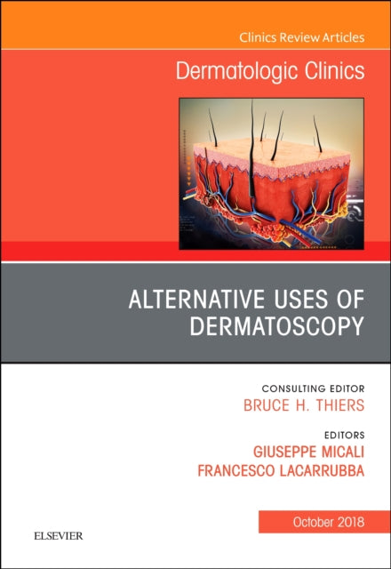 Book cover of: Alternative Uses of Dermatoscopy, An Issue of Dermatologic Clinics. By: Giuseppe Micali