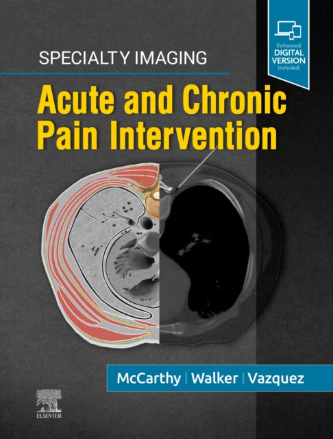 Book cover of: Specialty Imaging: Acute and Chronic Pain Intervention. By: Colin J. McCarthy