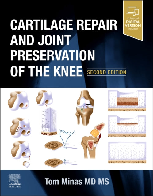 Book cover of: Cartilage Repair and Joint Preservation of the Knee. By: Tom Minas