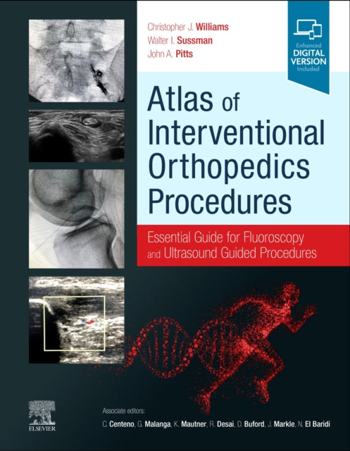 Book cover of: Atlas of Interventional Orthopedics Procedures. By: Christopher J. Williams