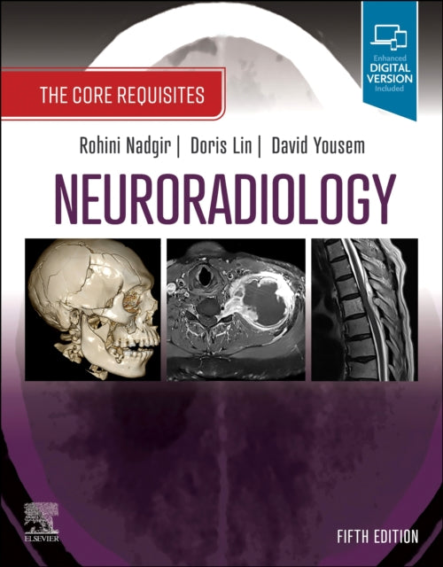 Book cover of: Neuroradiology. By: Rohini Nadgir