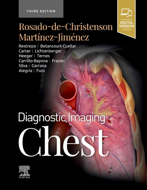 Book cover of: Diagnostic Imaging: Chest. By: Melissa L. Rosado-de-Christenson MD  FACR