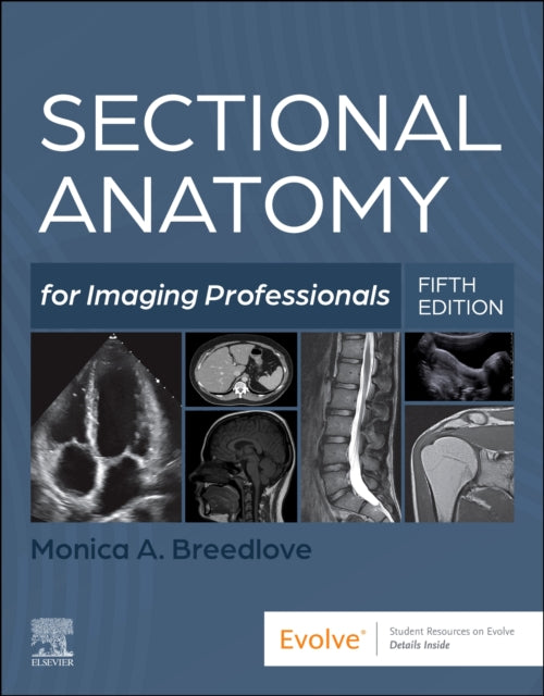 Book cover of: Sectional Anatomy for Imaging Professionals. By: Lorrie L. Kelley