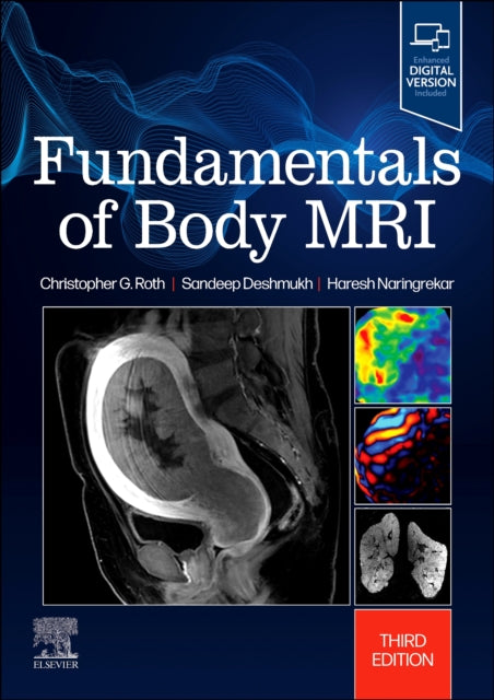 Book cover of: Fundamentals of Body MRI. By: Christopher G. Roth