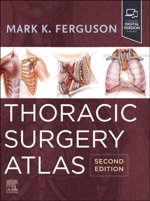Book cover of: Thoracic Surgery Atlas. By: Mark K. Ferguson