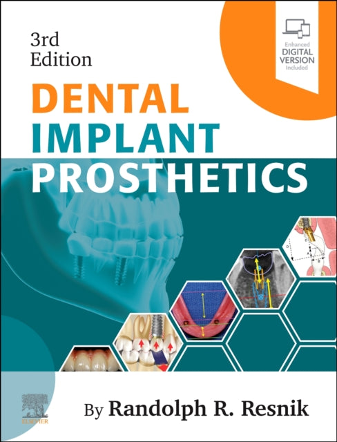 Book cover of: Dental Implant Prosthetics. By: Randolph Resnik
