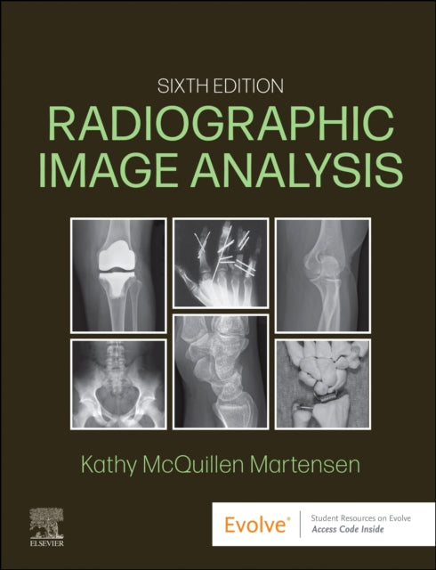 Book cover of: Radiographic Image Analysis. By: Kathy McQuillen-Martensen