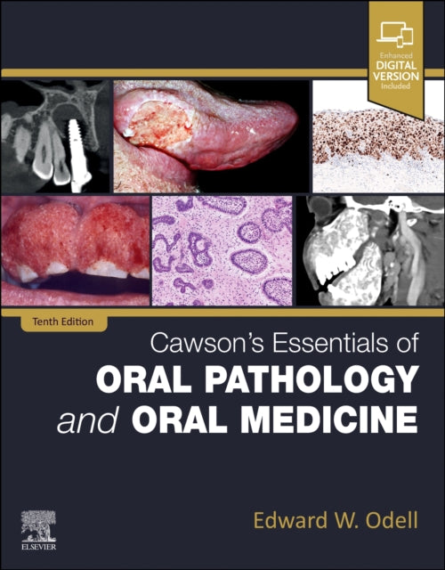 Book cover of: Cawson's Essentials of Oral Pathology and Oral Medicine. By: Edward W. Odell