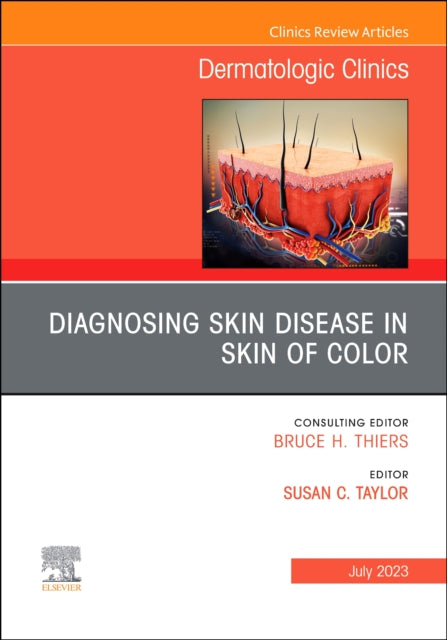 Book cover of: Diagnosing Skin Disease in Skin of Color, An Issue of Dermatologic Clinics. By: Susan C. Taylor
