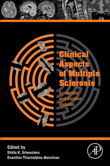 Book cover of: Clinical Aspects of Multiple Sclerosis Essentials and Current Updates. By: Shitiz Sriwastava