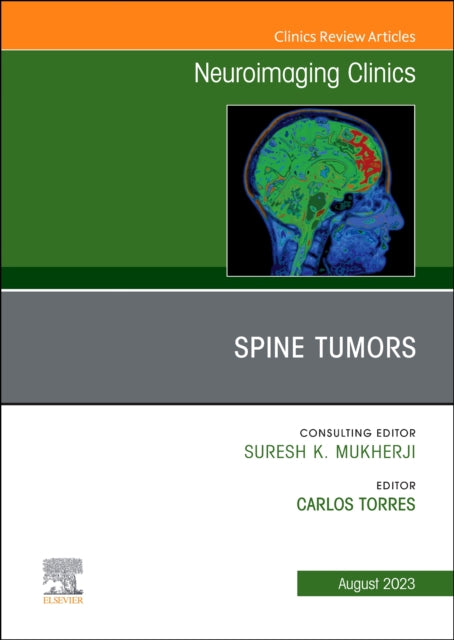Book cover of: MRI and Traumatic Brain Injury, An Issue of Neuroimaging Clinics of North America. By: Pejman Jabehdar Maralani