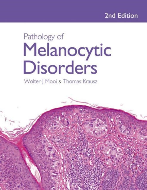 Book cover of: Pathology of Melanocytic Disorders 2ed. By: Wolter J. Mooi